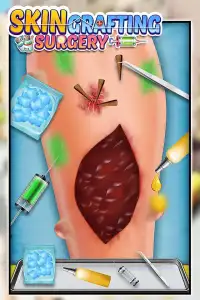 How to perform Skin Grafting Surgery Screen Shot 4
