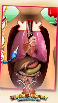 Lungs Surgery Simulator 3D Screen Shot 4