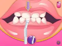 Crazy Dentist Princess Game 2 Screen Shot 3