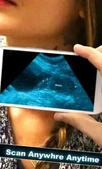 Baby Ultrasound Scanner :Prank Screen Shot 3