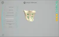 Virtual Cranium Screen Shot 7