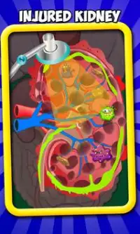 Kidney Doctor - Casual Game Screen Shot 3