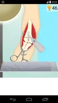 body surgery game Screen Shot 3