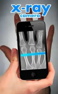 X-Ray Camera Fingers Screen Shot 0