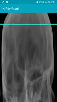 X Ray Scanner Prank Screen Shot 0