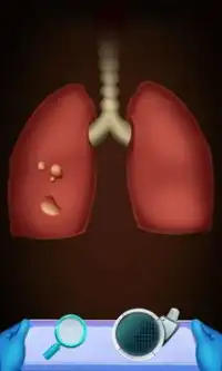 Tratamento de pulmão do bebê Screen Shot 2