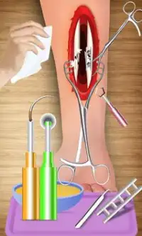Arm Bone Doctor: juegos de hospital y juegos de ci Screen Shot 15