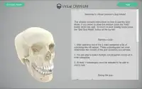 Virtual Cranium Screen Shot 4