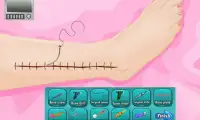 Leg Surgery Free Doctor Game Screen Shot 3
