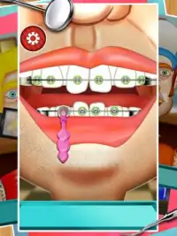 手術歯医者ゲームブレース Screen Shot 10
