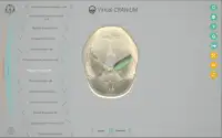 Virtual Cranium Screen Shot 3