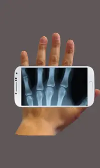 X-ray Cam Prank Screen Shot 0