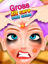 Gross Zit Care - OMG Game Screen Shot 3