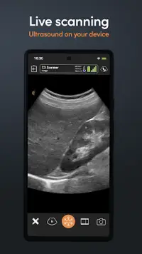 Clarius Ultrasound App Screen Shot 1