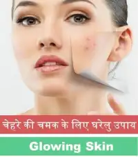 Beauty Tips Skin Care Tips Screen Shot 0