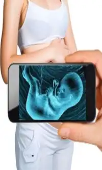 Ultrasound Scanner (Prank) Screen Shot 0
