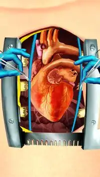 Open Heart Surgery Simulator Screen Shot 5