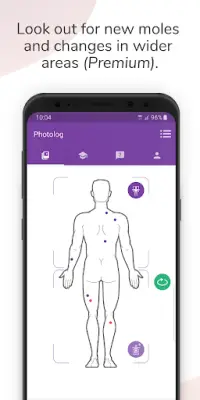 Miiskin - Skin Cancer eHealth. Track & Check Moles Screen Shot 2