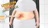 Liposuction Surgery Simulator Screen Shot 3