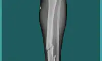 Leg Surgery Doctor Sim 2016 Screen Shot 2