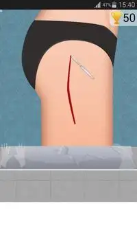 कूल्हे की सर्जरी के खेल Screen Shot 0
