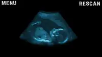Scanner X-Ray Joke Ultrasound Screen Shot 1