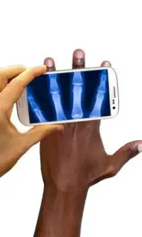 X-ray Human Scanner: Prank Screen Shot 1