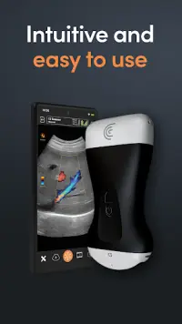 Clarius Ultrasound App Screen Shot 0