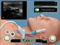 Ultrasound Guided Vascular Access Simulation Screen Shot 2