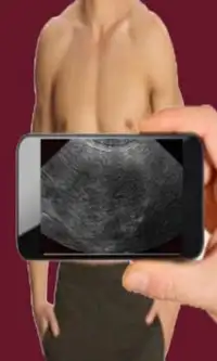 Ultrasound Scanner (Prank) Screen Shot 1