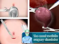 Live Surgery : Operation For All Surgery Screen Shot 2