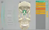Virtual Cranium Screen Shot 6