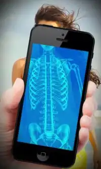 Human X Ray Scanner (Prank) Screen Shot 4