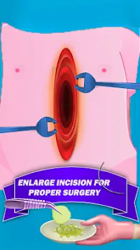 Intestine Surgery Simulator Screen Shot 2