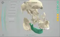 Virtual Cranium Screen Shot 2