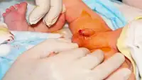 Real Circumcision Surgery Simulator:cirugíade bebé Screen Shot 3
