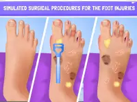 Nail Surgery Foot Toe Doctor Screen Shot 4