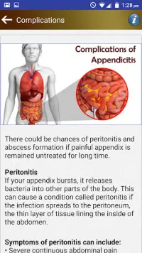 Appendix Diet Foods Help Tips Screen Shot 4