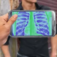 X-Ray Phone Joke Screen Shot 1