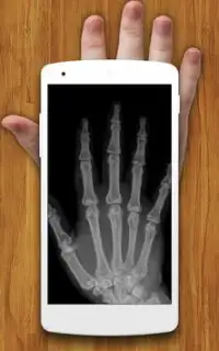 X-ray Scanner Prank Screen Shot 2