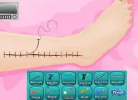 Leg Surgery Free Doctor Game Screen Shot 11