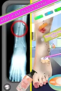 Leg Surgery Simulator Screen Shot 1