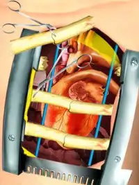 Open Heart Surgery Simulator Screen Shot 15