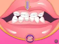 Crazy Dentist Princess Game 2 Screen Shot 4