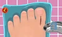 Toe Surgery Doctor Game Screen Shot 5