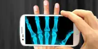 Jelly Phone X-Ray :Prank Screen Shot 0