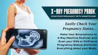 Xray Scanner Pregnant Prank New Screen Shot 2