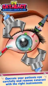 Eye Cataract Surgery Simulator Screen Shot 2