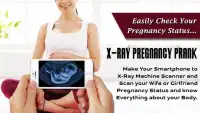 Xray Scanner Pregnant Prank New Screen Shot 1