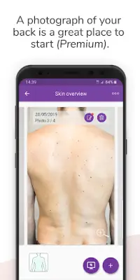 Miiskin - Skin Cancer eHealth. Track & Check Moles Screen Shot 3